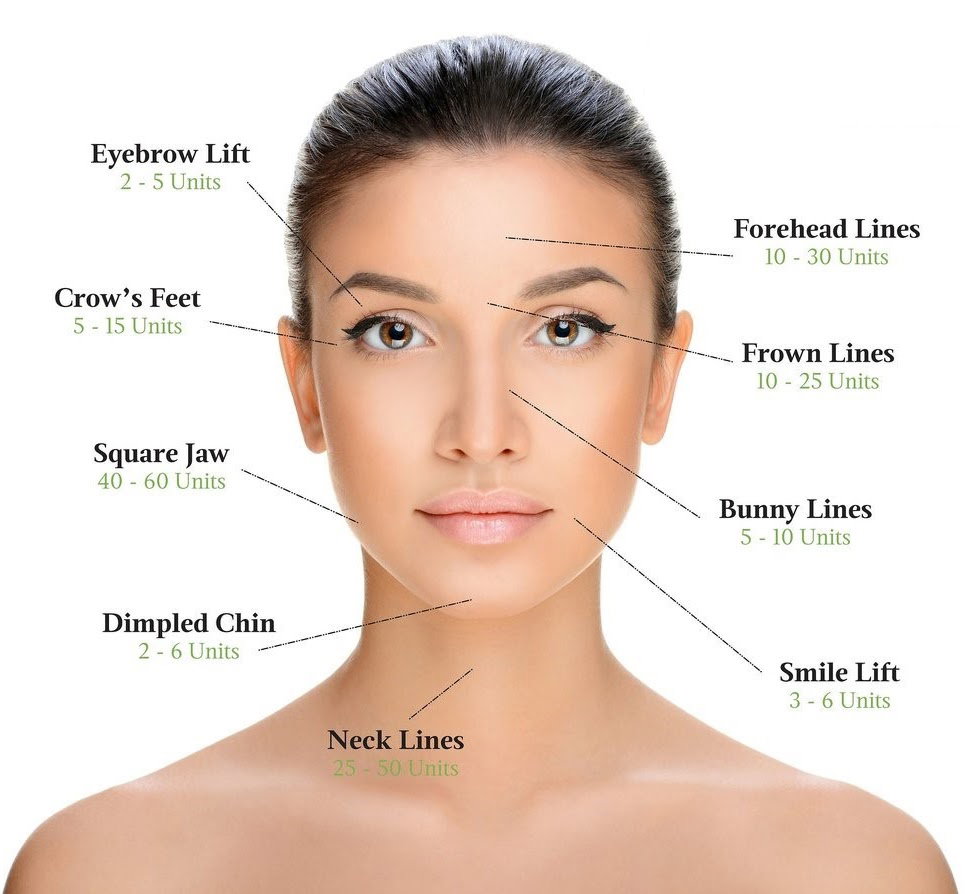 Botox, Dysport, Xeomin, & Daxxify