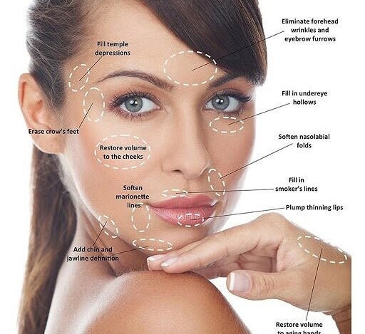 Dermal Fillers